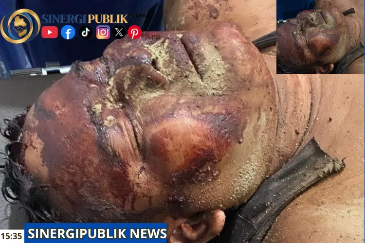 Diserang Saat Azan Maghrib, Pondok Warga Dibakar dan Musholla Dihancurkan di Lahan Eks HGU 366 Hektar